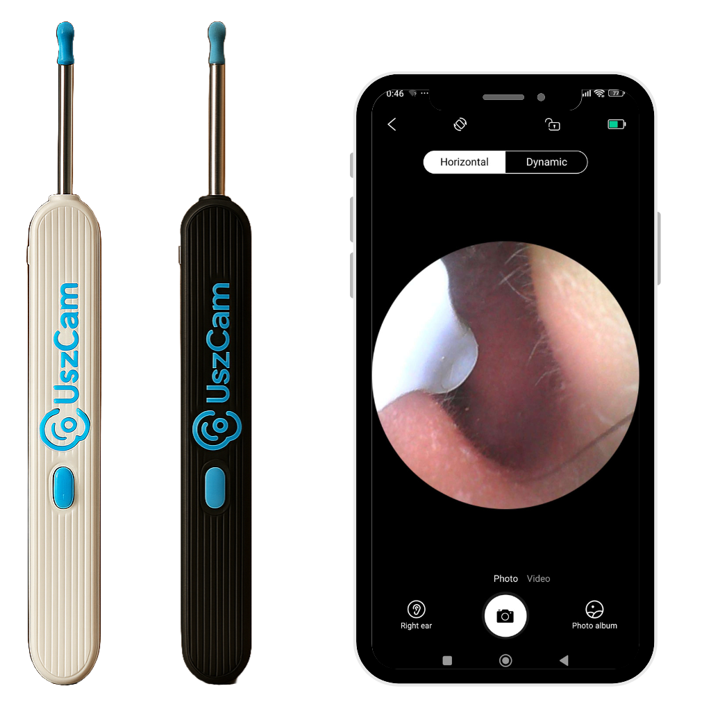 UszCam™ – czyścik do uszu z kamerką