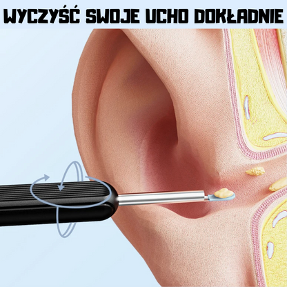 UszCam™ – czyścik do uszu z kamerką